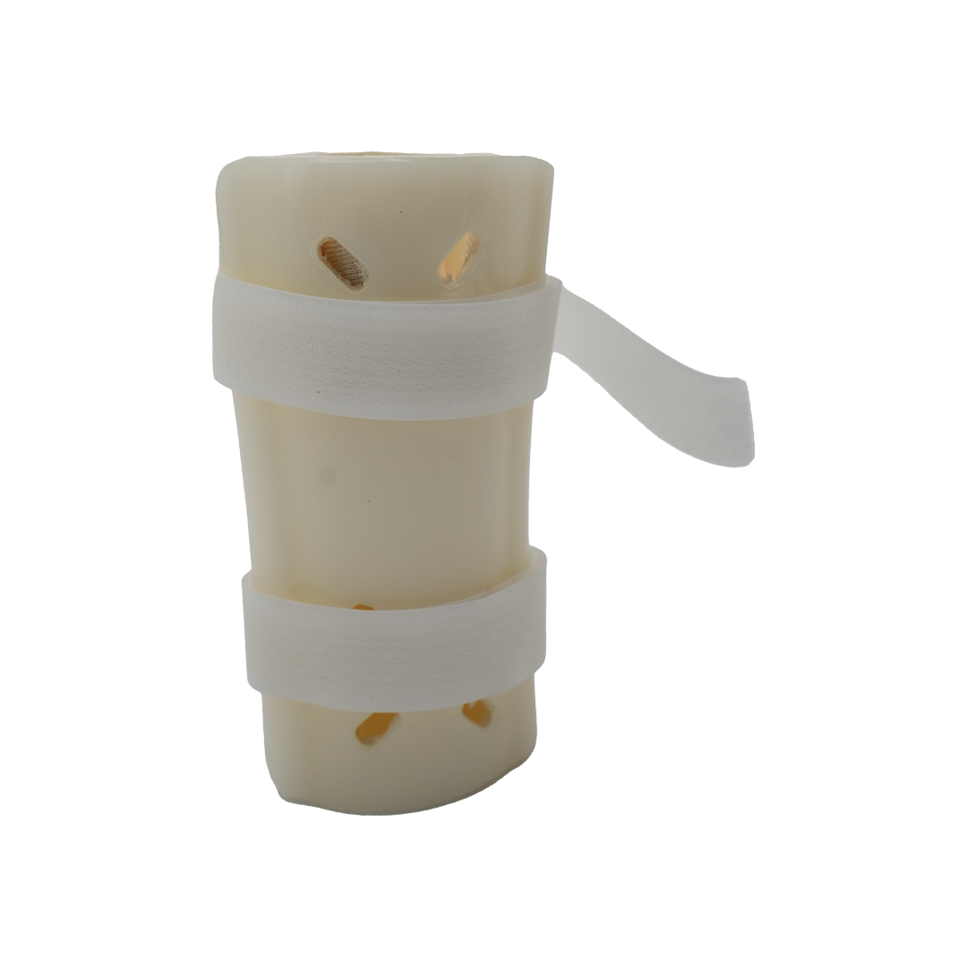 Pediatric forearm orthosis with beige rigid shell and two adjustable white Velcro straps.
