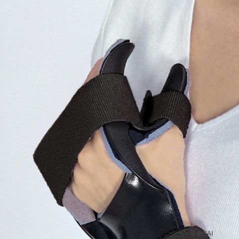 Dorsal Resting Hand Orthosis with Finger Separators