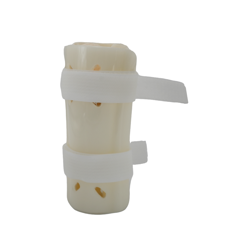 White pediatric forearm fracture orthosis with two adjustable hook-and-loop straps and ventilation holes.